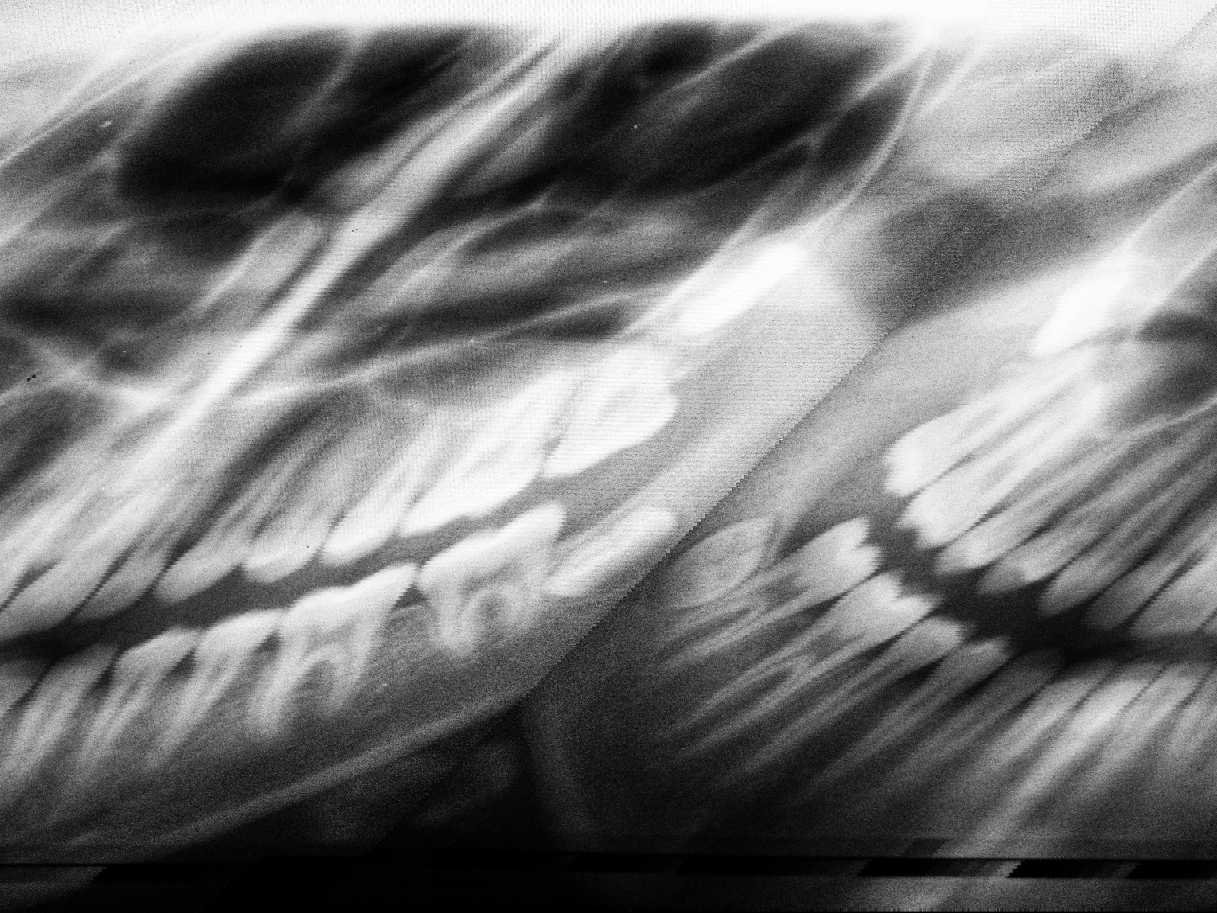 Röntgen Teknikeri ve Teknisyeni Nedir?